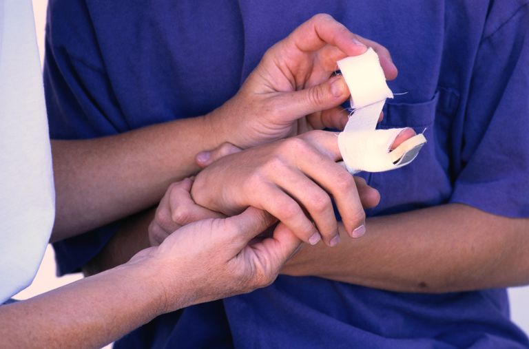 artrīts parasti, atkārtoti piestiprināt, bieži vien, nepieciešama ķirurģiska, pirkstu locītavu, pirkstu traumu