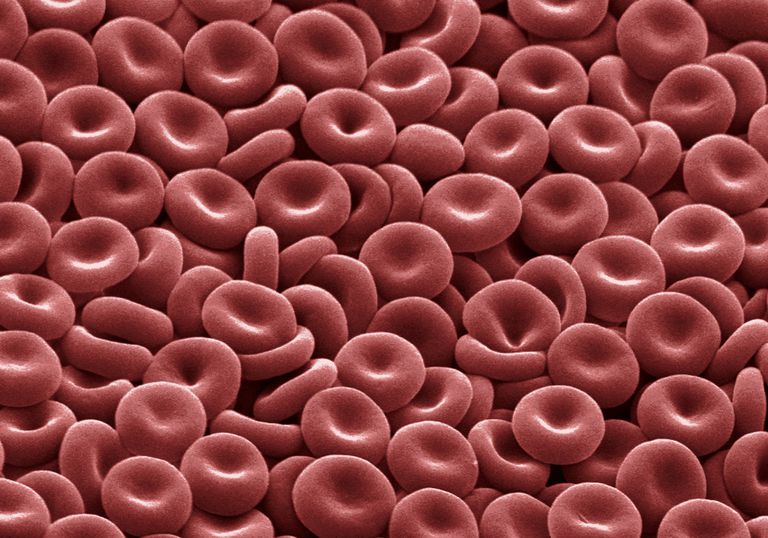 asins šūnu, sarkano asins, sarkano asins šūnu, izraisīt anēmiju, kaulu smadzenēs