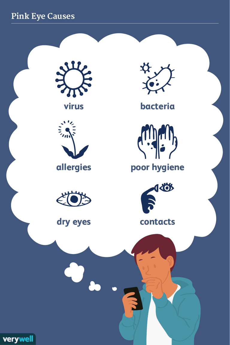 alerģiskas reakcijas, alerģisko konjunktivītu, ārvalstu ķermeņa, herpes simplex, hlamīdijas gonoreju, iekļūst acīs