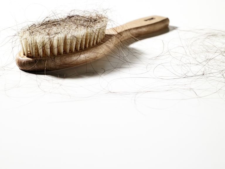 matu izkrišanu, matu izkrišana, imūnsistēma uzbrūk, izraisīt matu, izraisīt matu izkrišanu, nepietiekamu uzturu