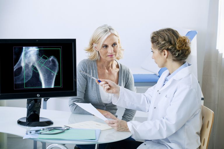 lūzumu risku, kaulu blīvumu, mugurkaula lūzumu, osteoporozes ārstēšanai, ārstēšanai sievietēm, gūžas kaula