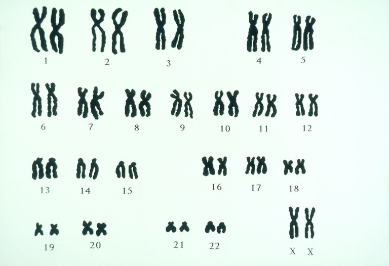 FISH analīzes, FISH analīze, hromosomas indivīds, hromosomas struktūru