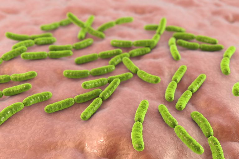 bakteriālas infekcijas, Clue šūnas, Gardnerella Mobiluncus, tiek veikts