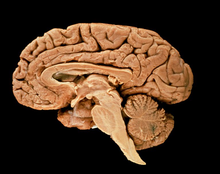 smadzeņu stumbra, Smadzeņu stublājs, ietekmē smadzeņu, ietekmē smadzeņu stumbra