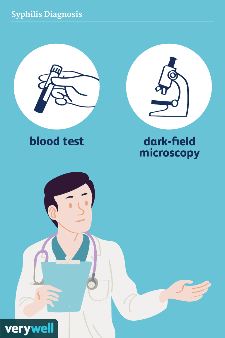 asins analīzes, bieži vien, lauka mikroskopija, antivielas tiek, asins analīžu, nespēj atšķirt