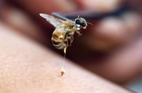alerģija pret, alerģiskas reakcijas, alerģija pret bišu, anafilaktisku reakciju, atbrīvo smaržu, bišu dzēlieniem