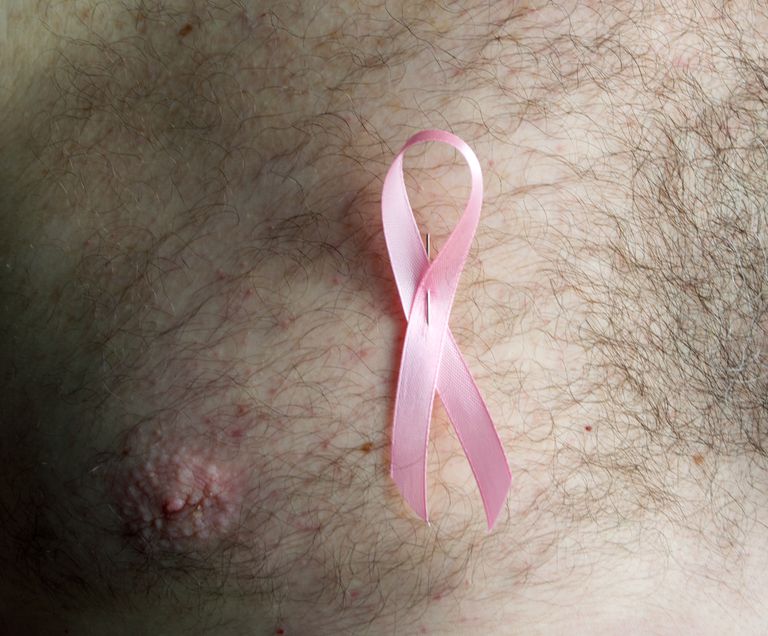 krūts vēža, vīriešu krūts vēža, krūts Vēzis, vīriešu krūts