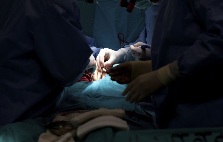 koronāro artēriju, Bypass Surgery, apvedceļa operācija, apvedceļa operācijas, artēriju apvedceļa