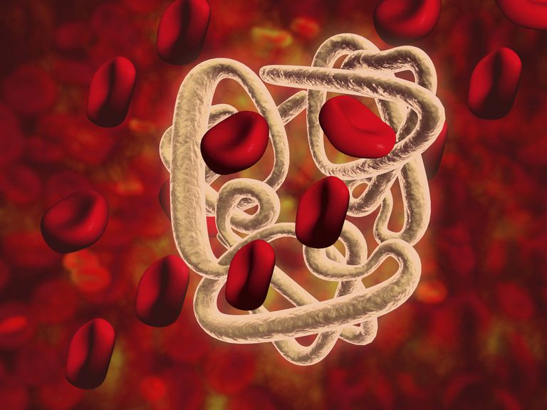 asins šūnu, sarkano asins, sarkano asins šūnu, alfa talasēmijas, alfa beta, alfa talasēmijas forma
