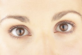 Ārstēšana pēc RAI palīdz novērst acu problēmas