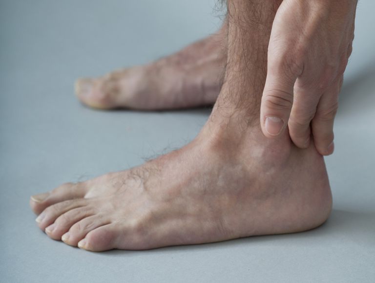 Achilles tendinīts, Jūsu ārsts, kāju potīšu, pēdu potīšu, potīšu tendonītu, Augsti izliektas
