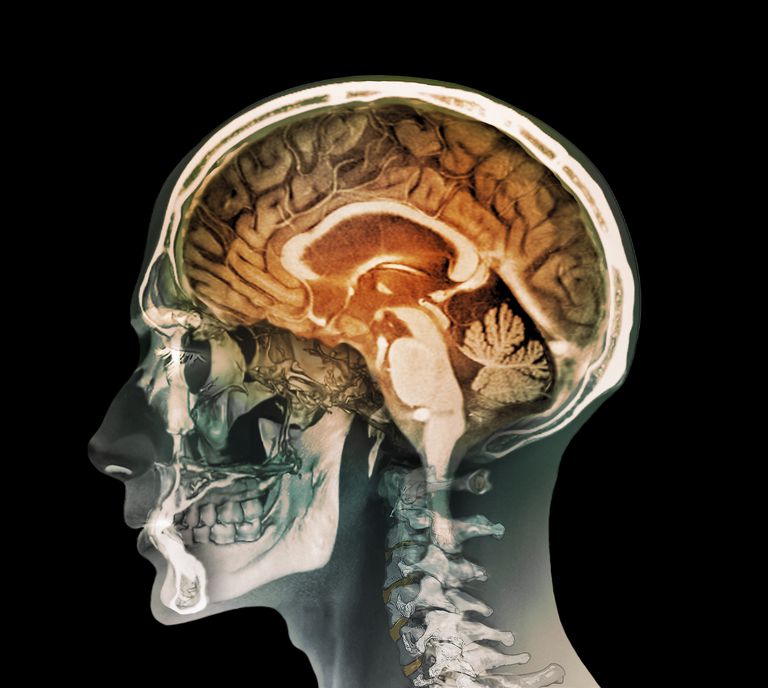 limbiskas sistēmas, hipotalāmu smadzeņu, limbiskā sistēma, limbiskās sistēmas, limbiskas sistēmas daļu, limbisko sistēmu