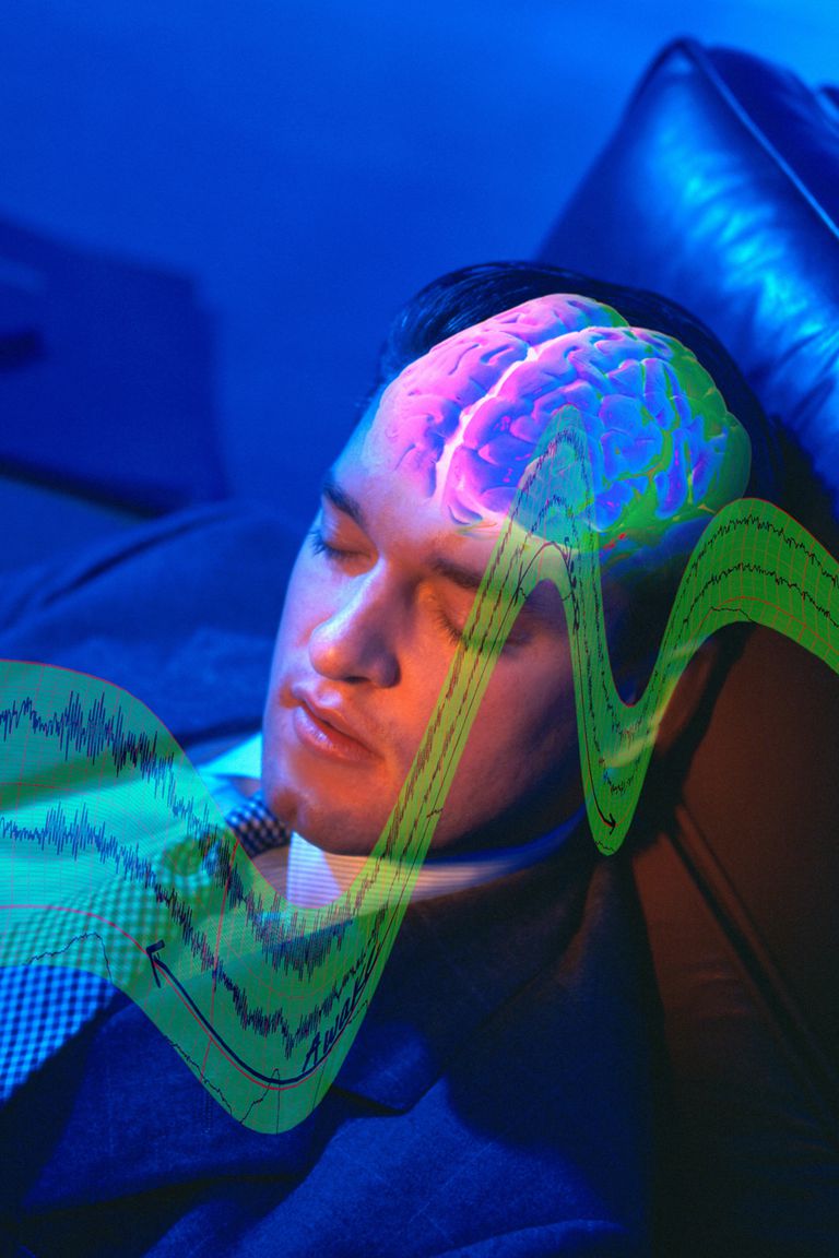 NREM miegs, smadzeņu viļņu, kustības miegs, miegs NREM, ātras kustības, ātrās kustības