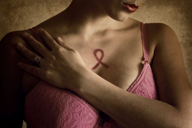 krūts vēža, krūts Vēzis, krūts vēzi, ārstēšanas iespējas, metaplastisku krūts